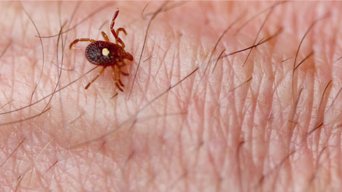 Tick on Skin