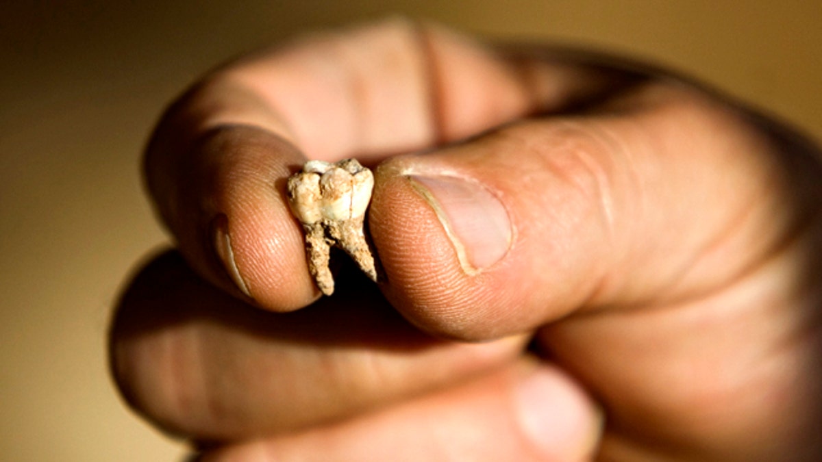 Mideast Israel Ancient Teeth