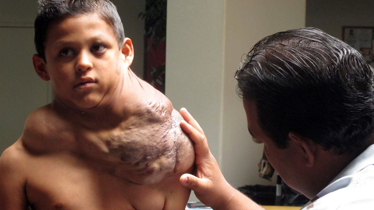 Boy Tumor