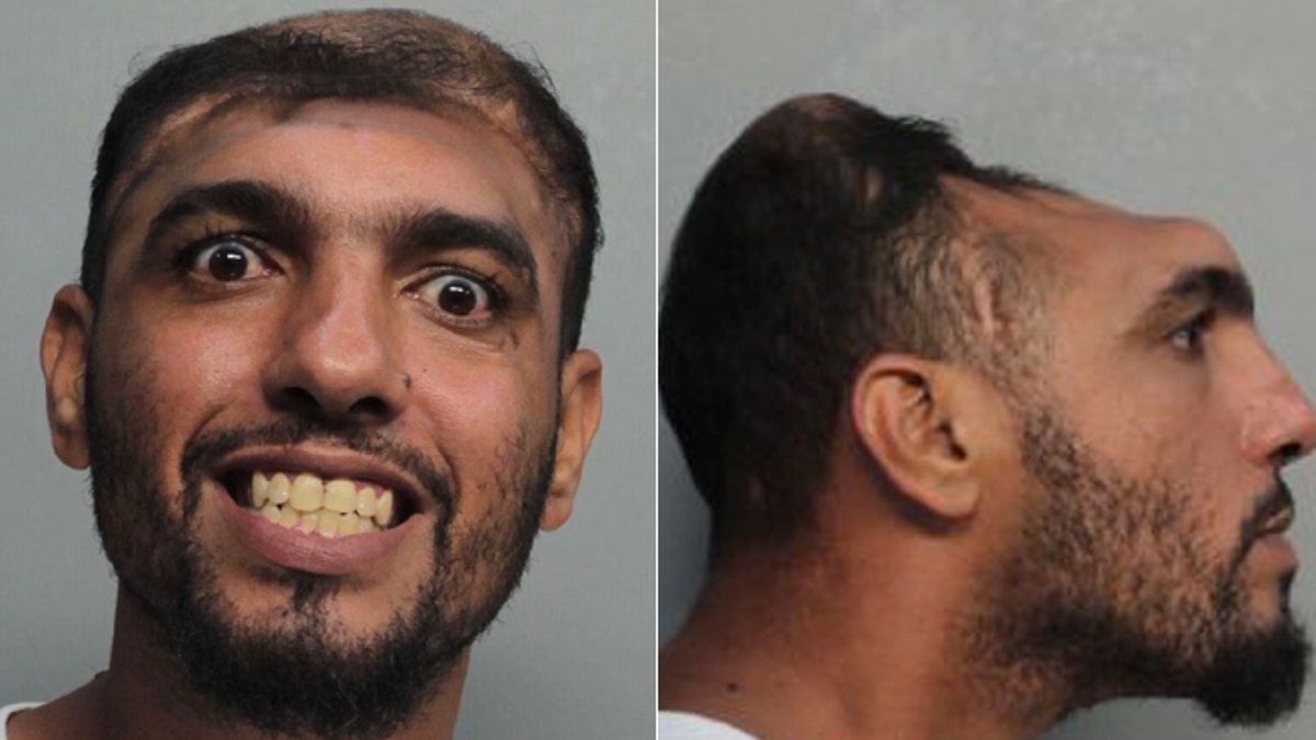 'Half-headed' Florida Man Arrested On Arson, Attempted Murder Charges ...