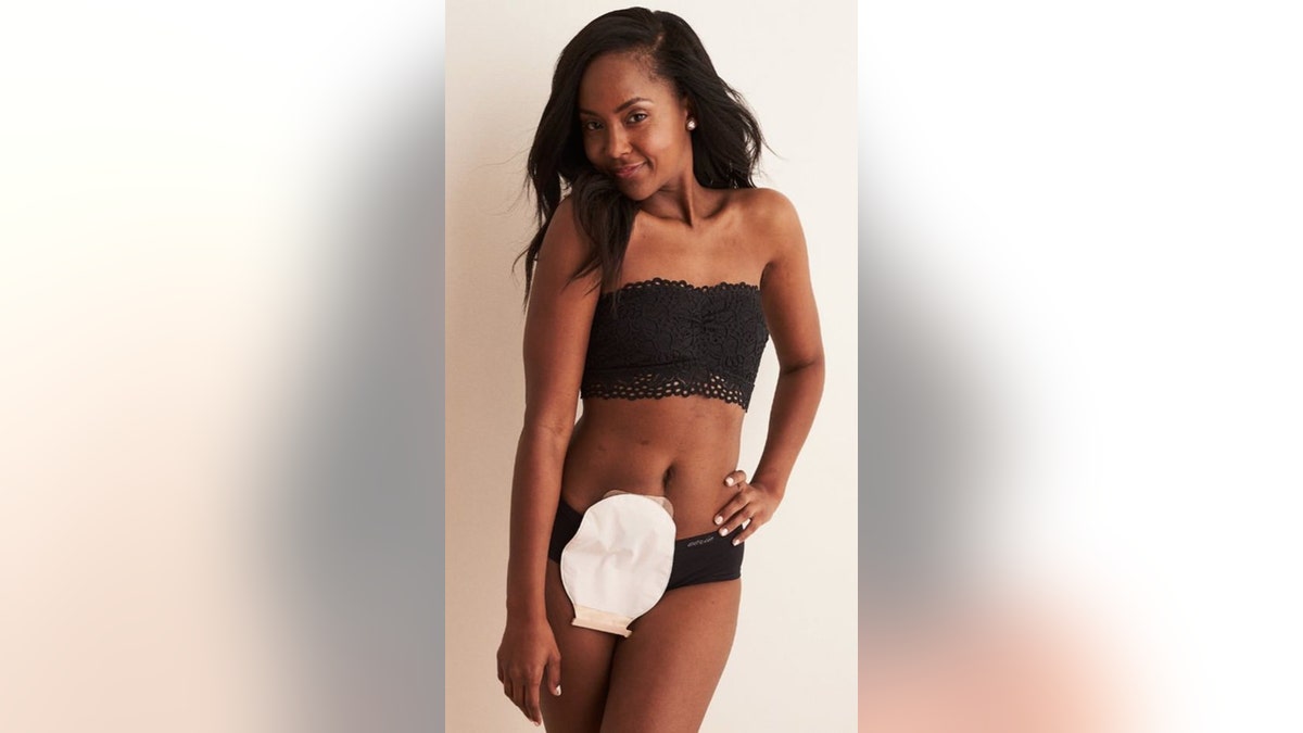 American Eagle has started using unretouched women to model their clothing  and underwear to promote body positivity.