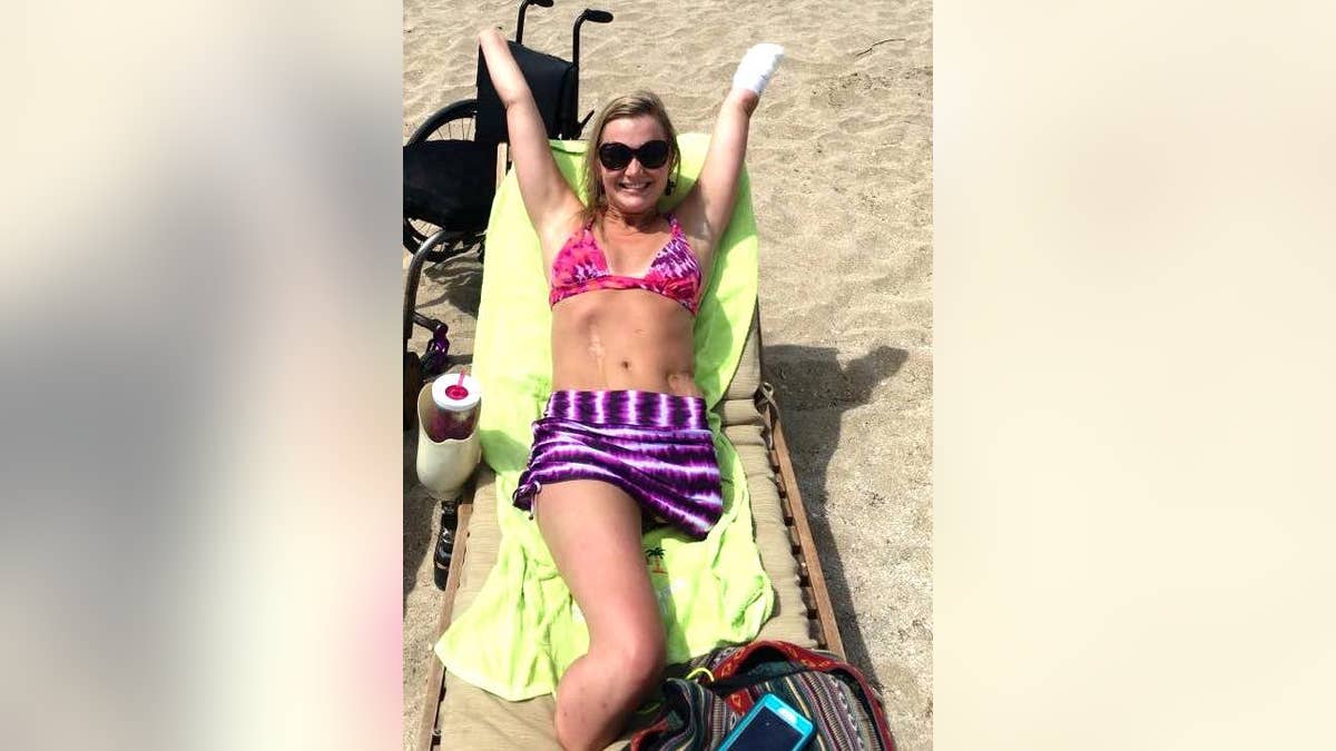 aimee copeland viral pic fox 5