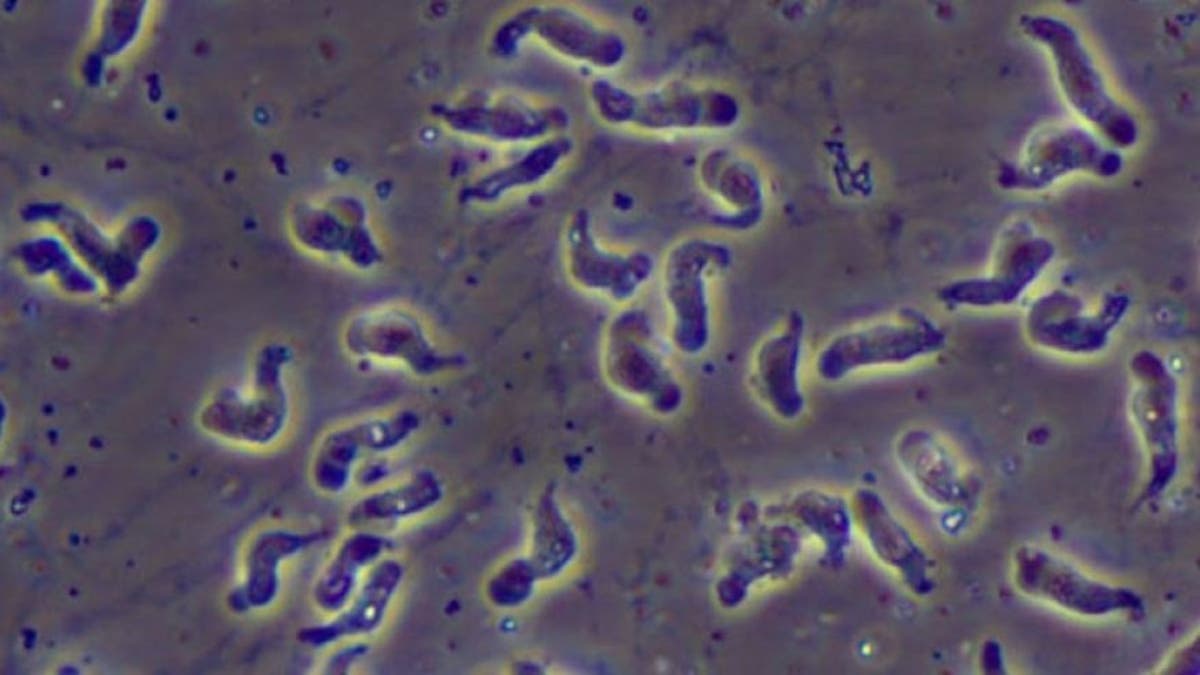 Naegleria fowleri