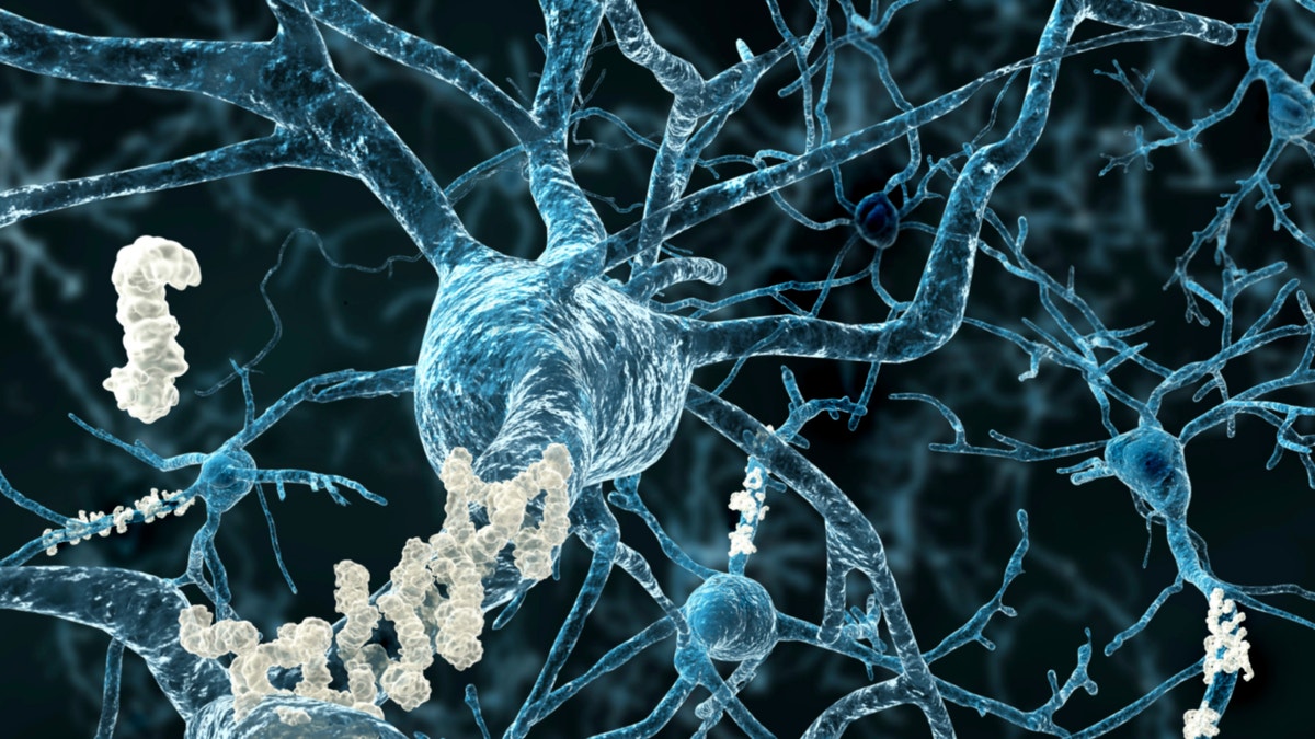 amyloid plaques istock 2.jpg