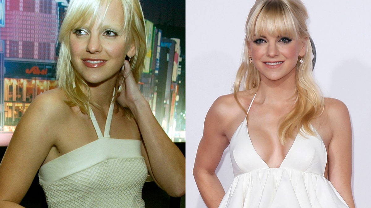 anna faris implants before after reuters