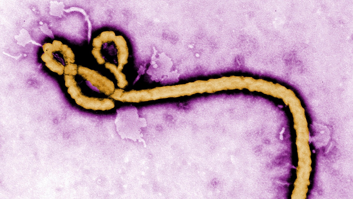 ebola AP