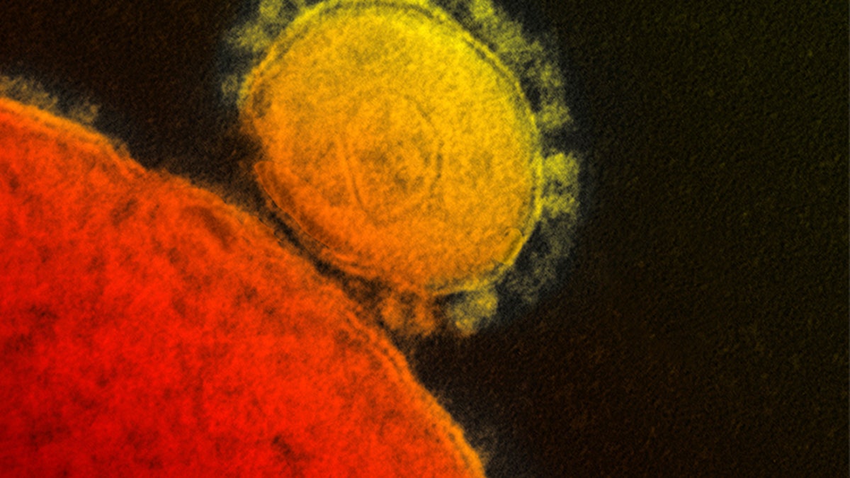 MERS Virus Saudi Outbreak