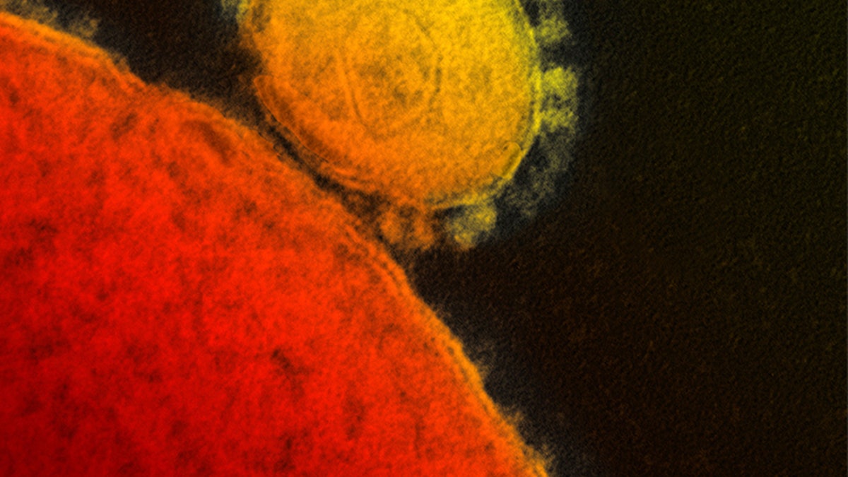 MERS Virus Saudi Outbreak