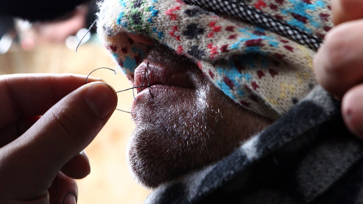 refugee mouths sewn shut 33