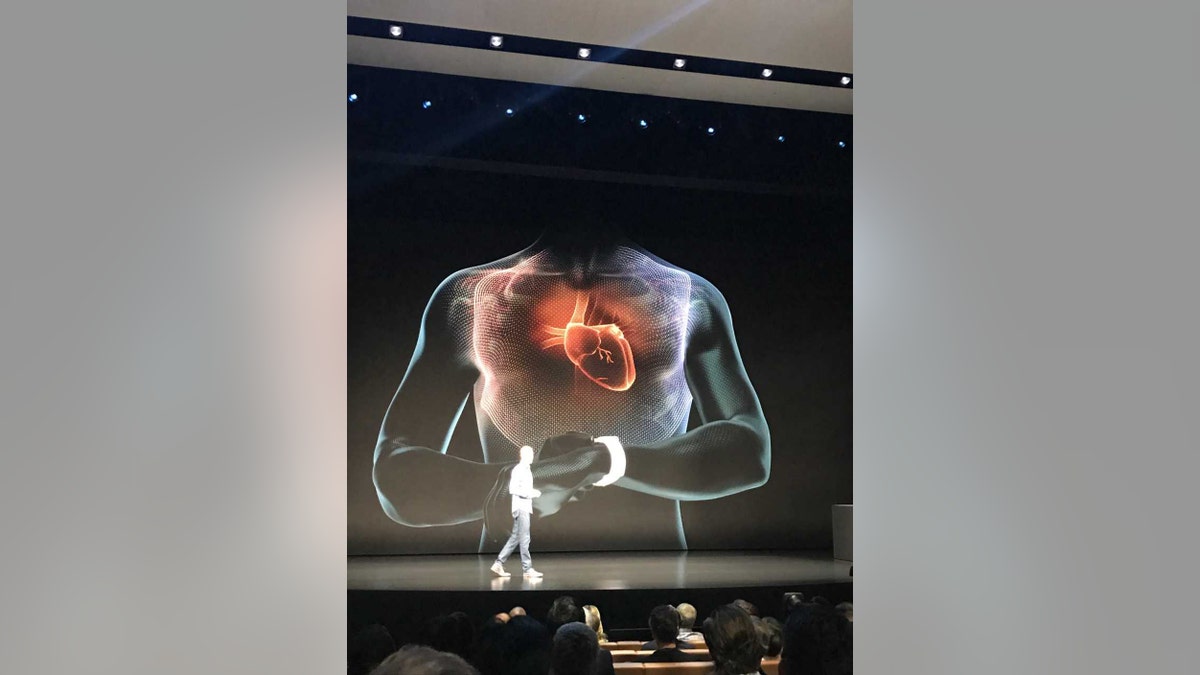 apple watch ecg