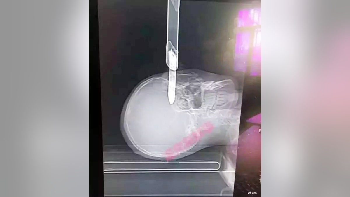 head_impaled_blade_CEN