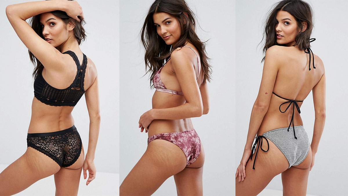 asos stretch marks