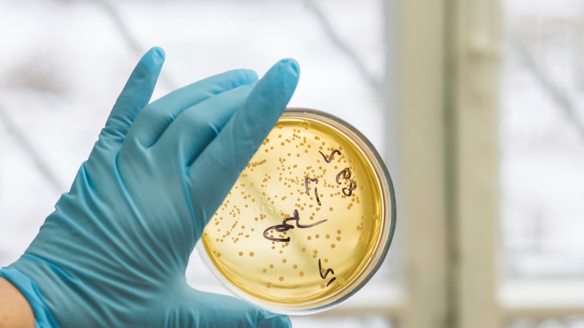bacteria in petri dish istock