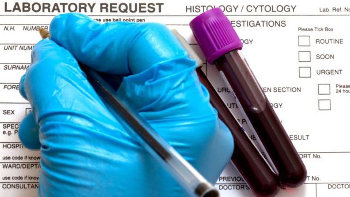 What Do Routine Blood Tests Check For? - Scripps Health