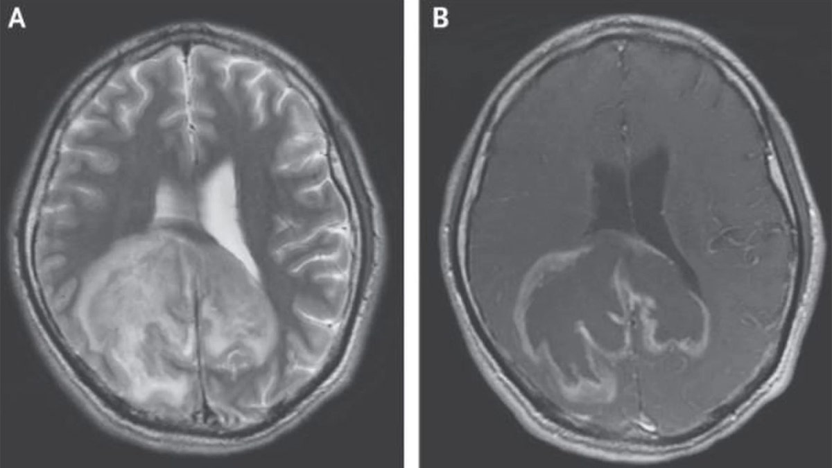 brain_scan_ls