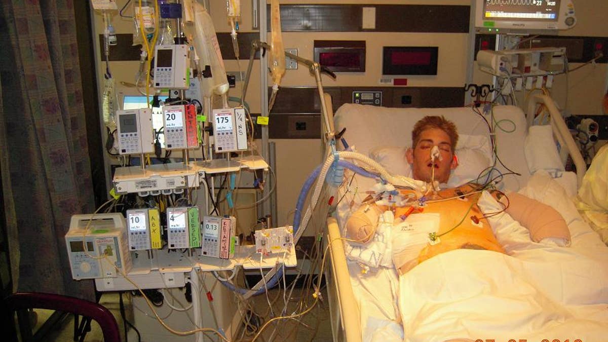 John Peck during his recovery after losing both of his arms and legs in an explosion in Afghanistan.