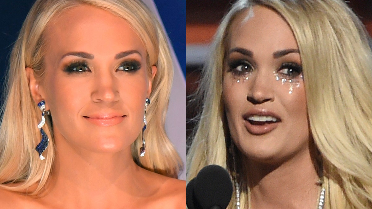 Carrie Underwood's face injury explained
