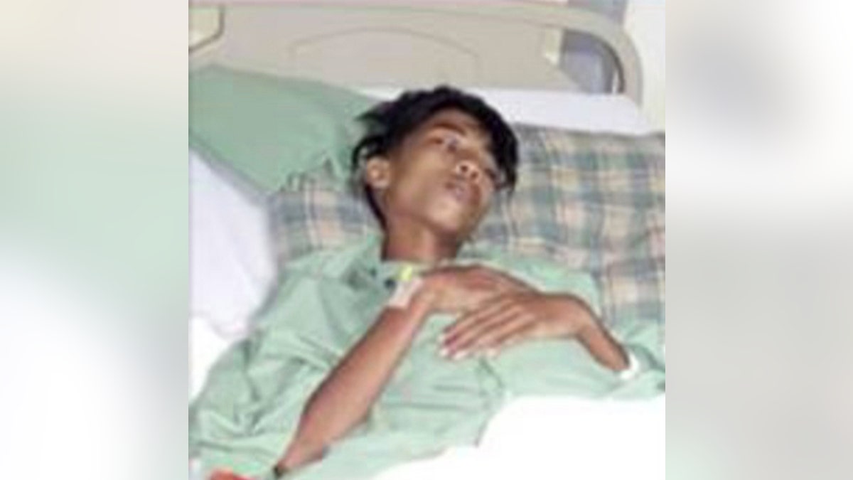 malaysiatwinfetus_CEN