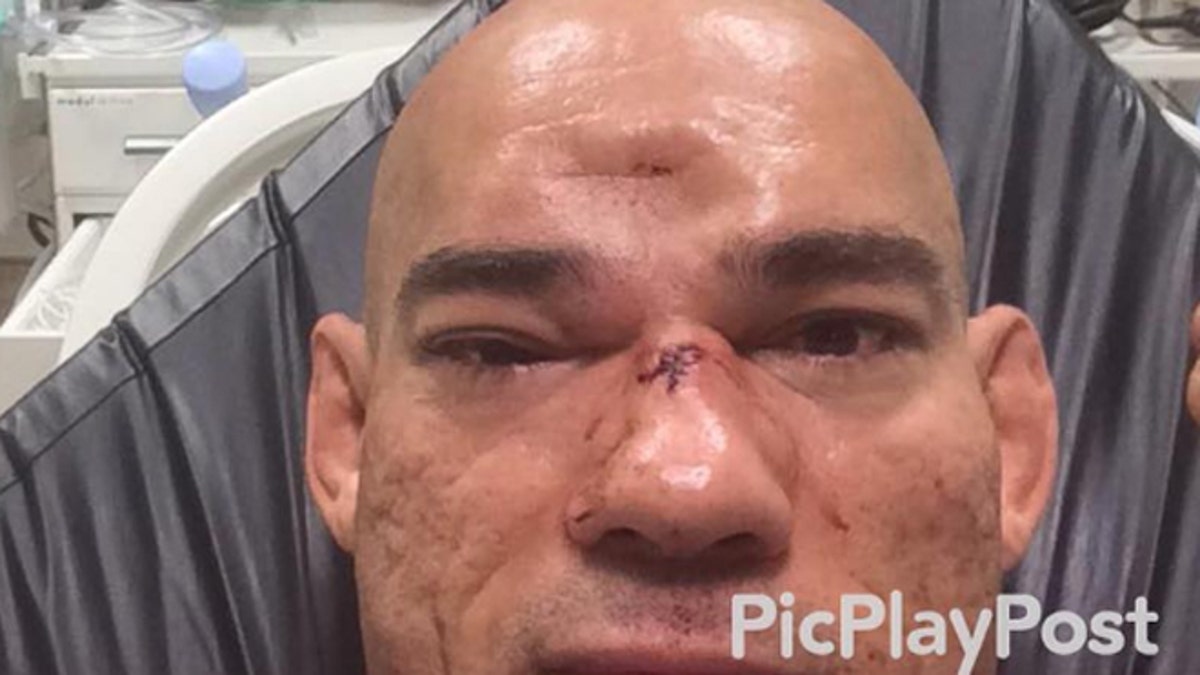 cyborg