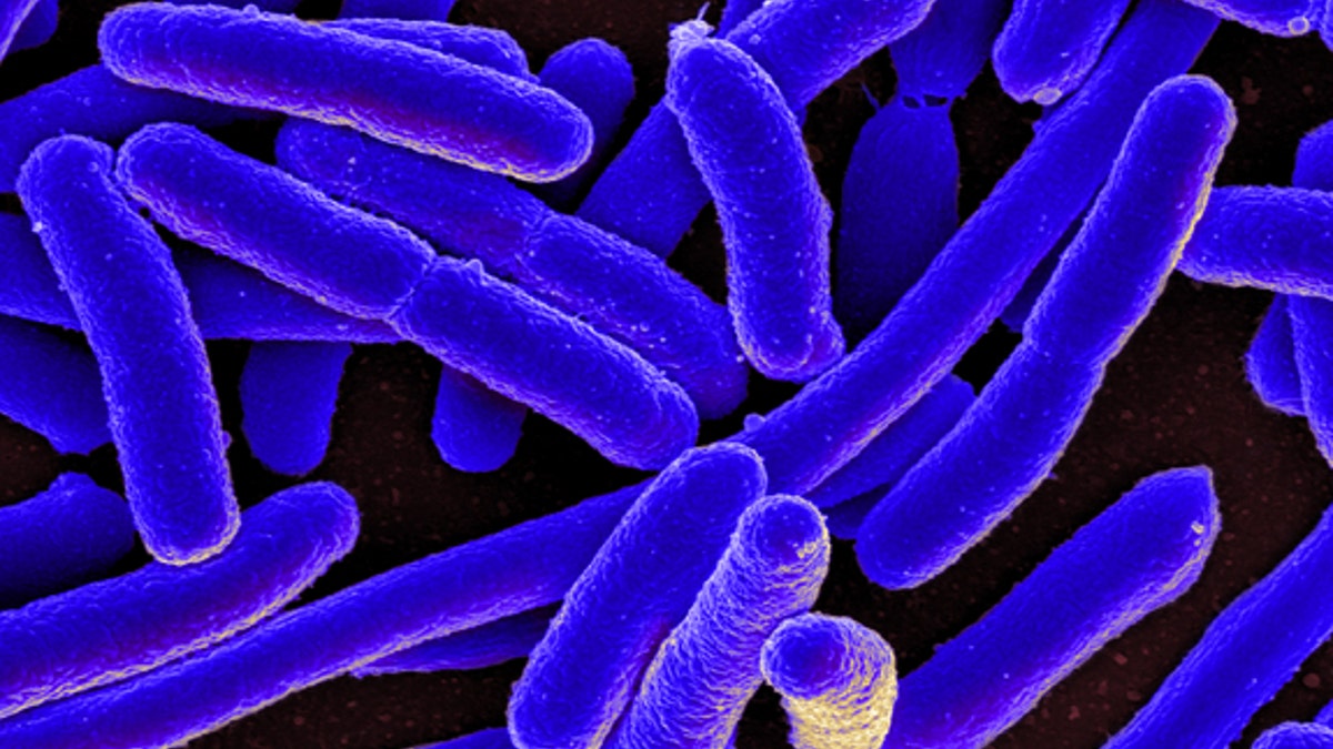 Scanning electron micrograph of Escherichia coli