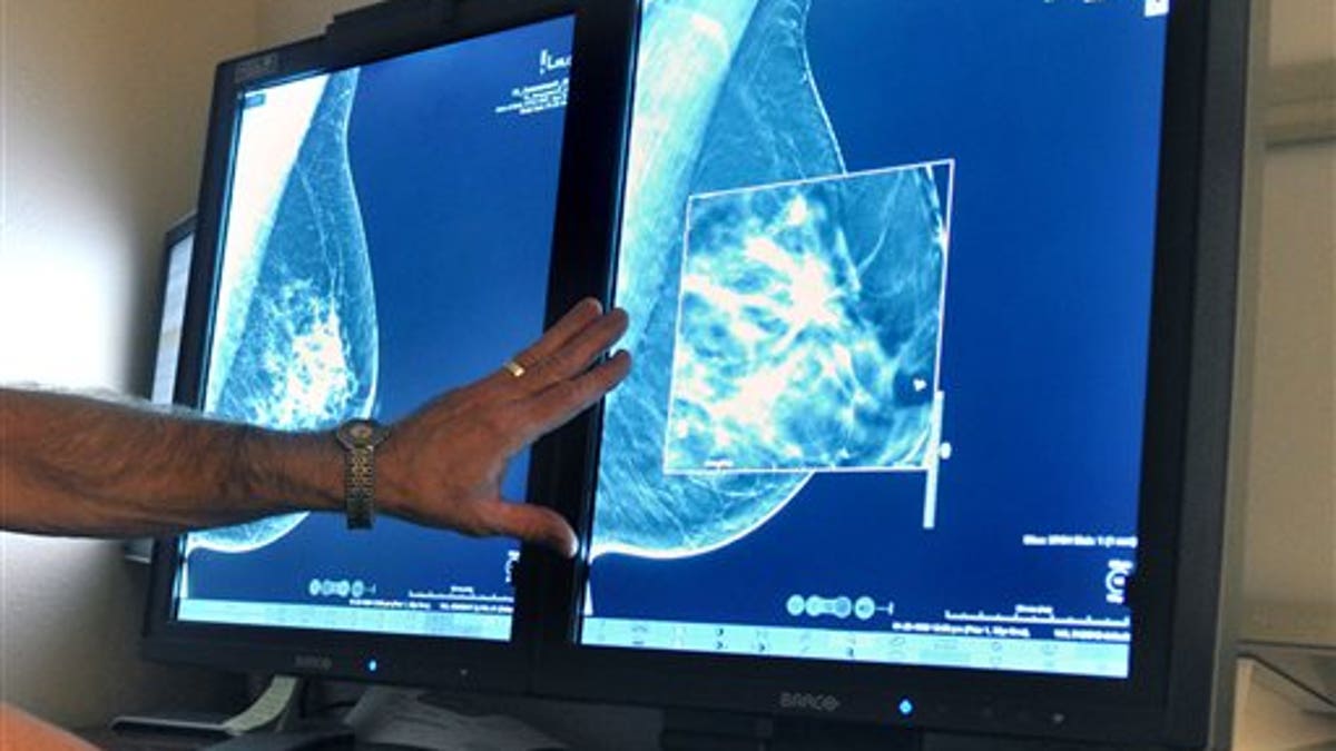 Early Breast Cancer