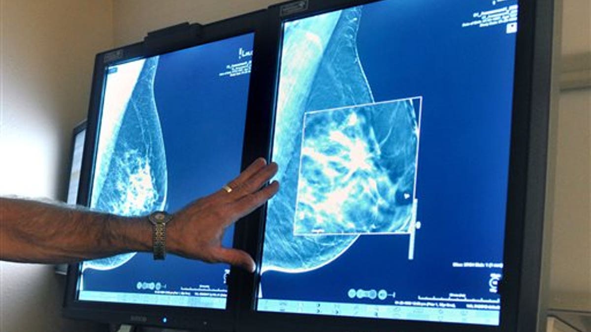 Early Breast Cancer