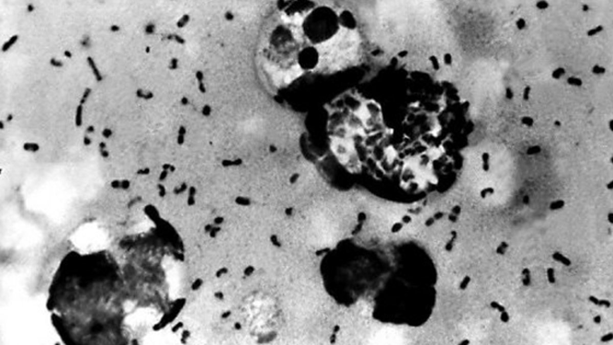 Bubonic plague bacteria from a patient, in a photo obtained on 15 January 2003 from the US Centers For Disease Control.