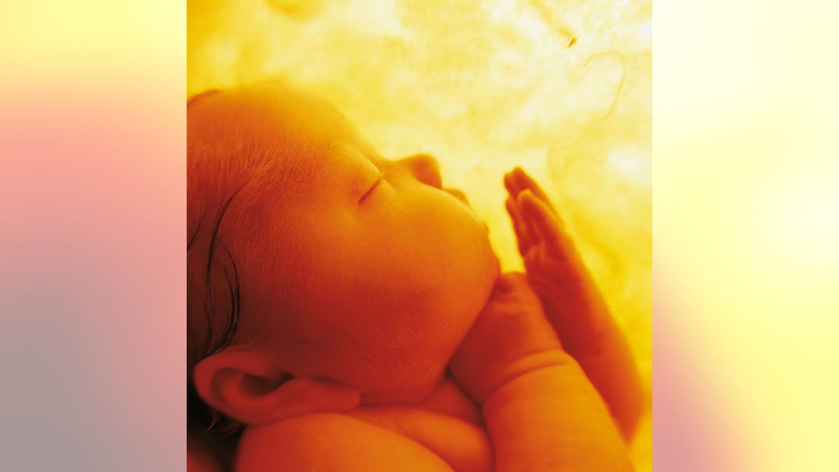 Anne Geddes photos