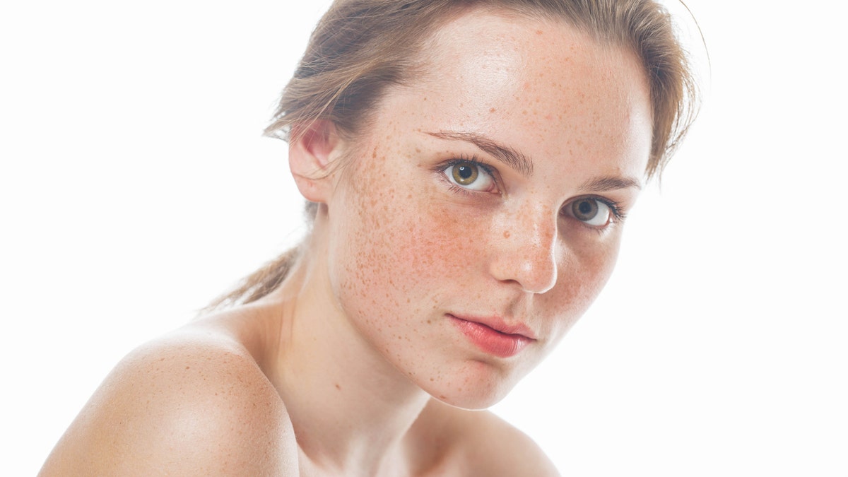 freckles freckled face istock medium
