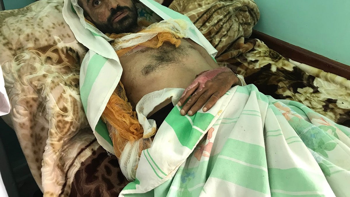 yemen torture victim