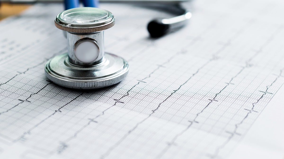 Close-up of a stethoscope on ECG printout.