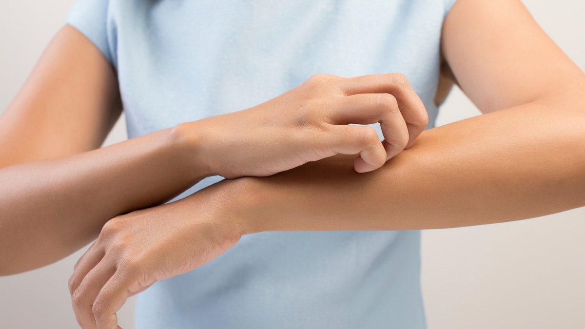 scratching_arm_woman_istock