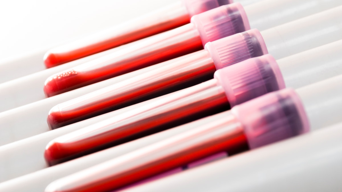 blood_samples_istock