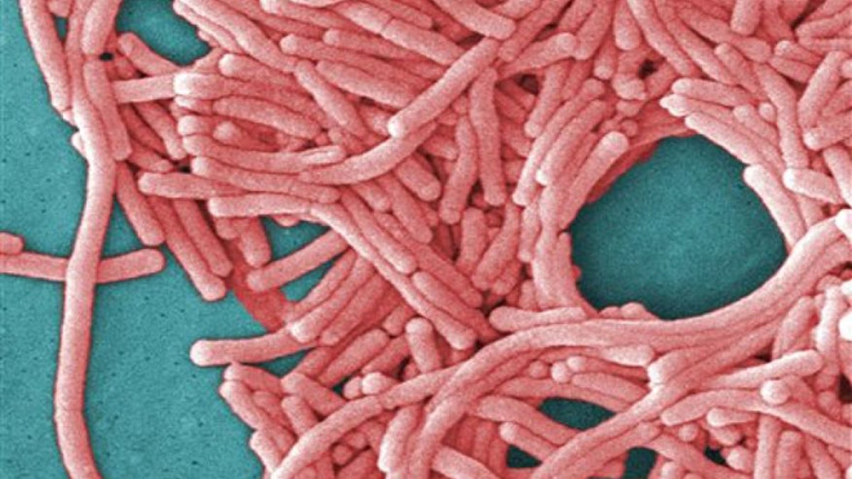 This undated image made available by the Centers for Disease Control and Prevention shows a large grouping of Legionella pneumophila bacteria (Legionnaires' disease.