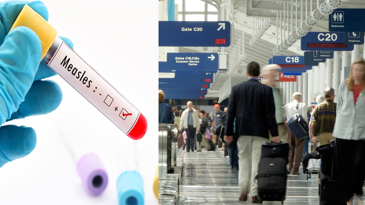 Measles airport split