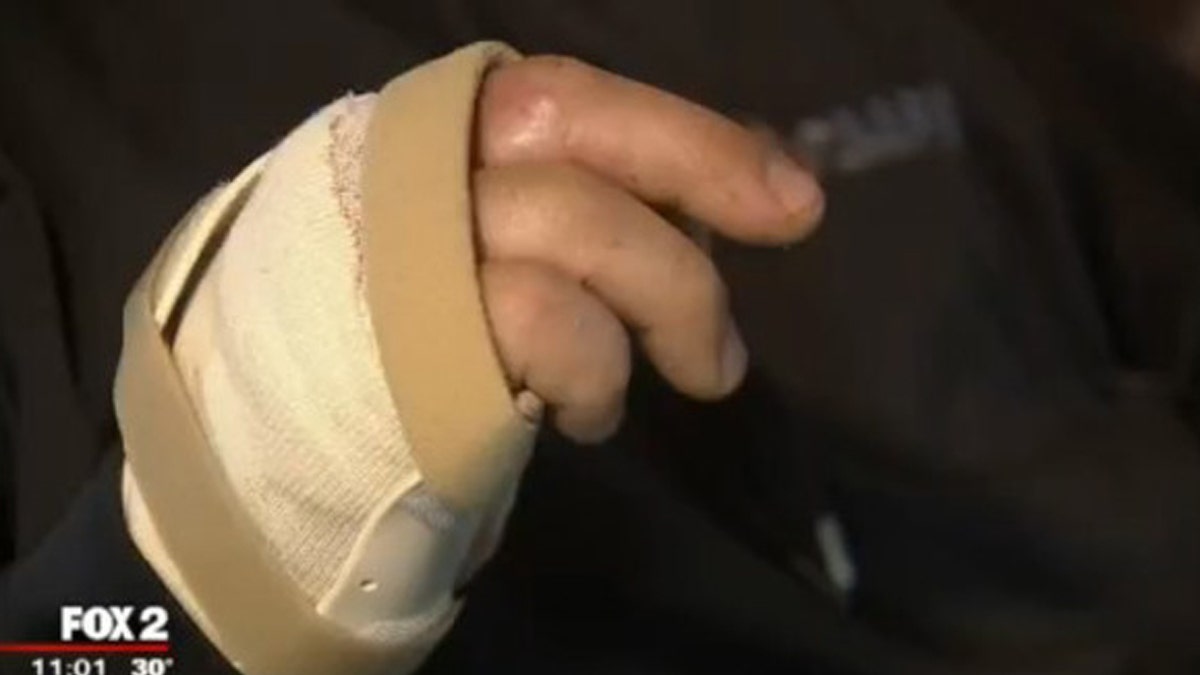 michican cop finger bandage