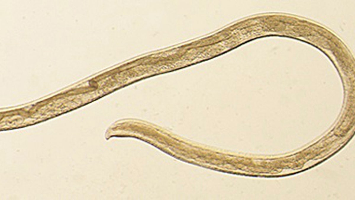 oregon eye worm 2