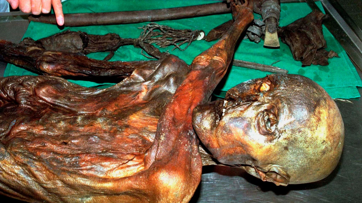 Otzi