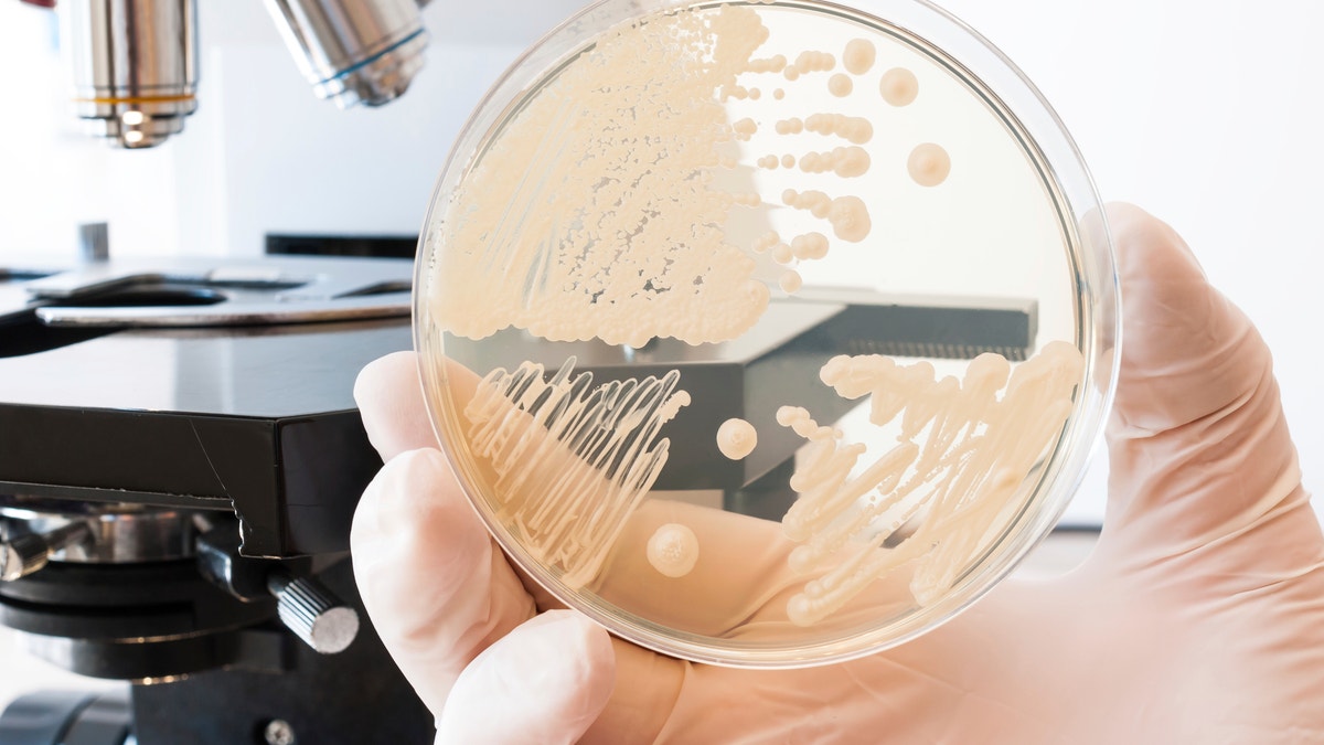 petri dish with bacteria istock