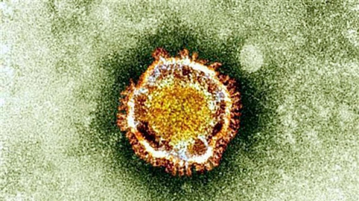 This undated handout picture courtesy of the British Health Protection Agency shows the coronavirus seen under an electron miscroscope. Saudi Arabia will not issue visas to the elderly, pregnant women or children for the hajj and umrah pilgrimages to help combat the spread of MERS coronavirus, the French health ministry said on Tuesday.