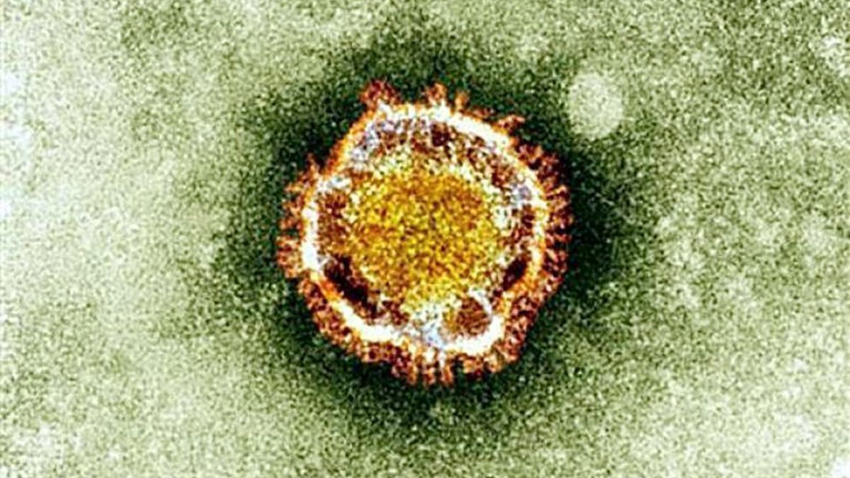 This undated handout picture courtesy of the British Health Protection Agency shows the coronavirus seen under an electron miscroscope. Saudi Arabia will not issue visas to the elderly, pregnant women or children for the hajj and umrah pilgrimages to help combat the spread of MERS coronavirus, the French health ministry said on Tuesday.