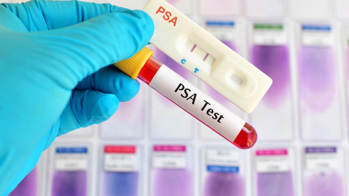 psa test prostate cancer 