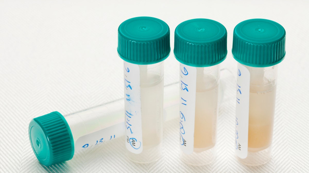 saliva samples for laboratory test