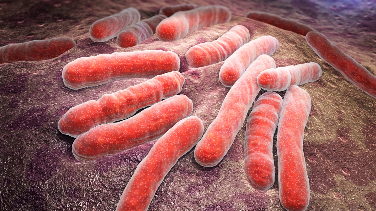 tuberculosis TB graphic istock large