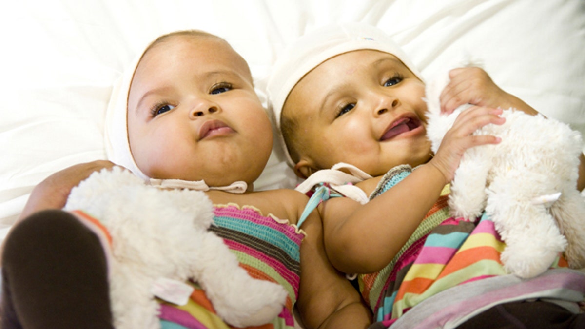 CONJOINED TWINS/SURGERY