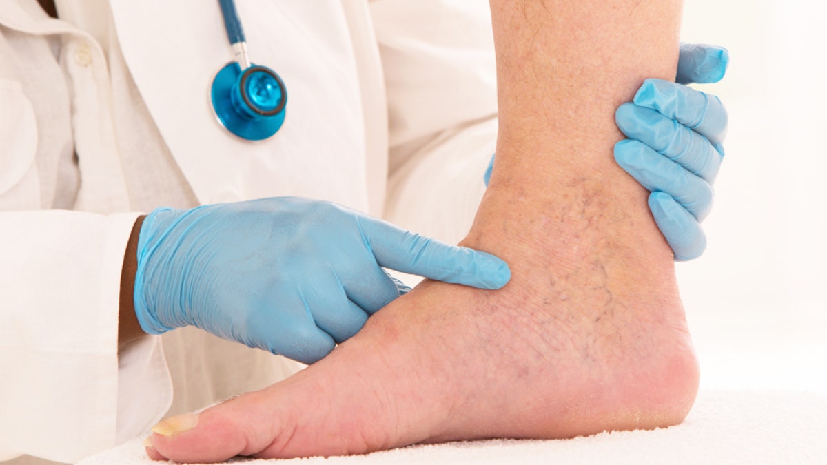 Lower limb vascular examination