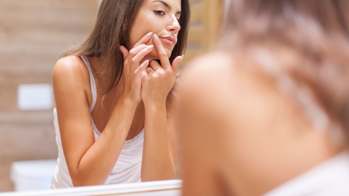 young woman with acne istock