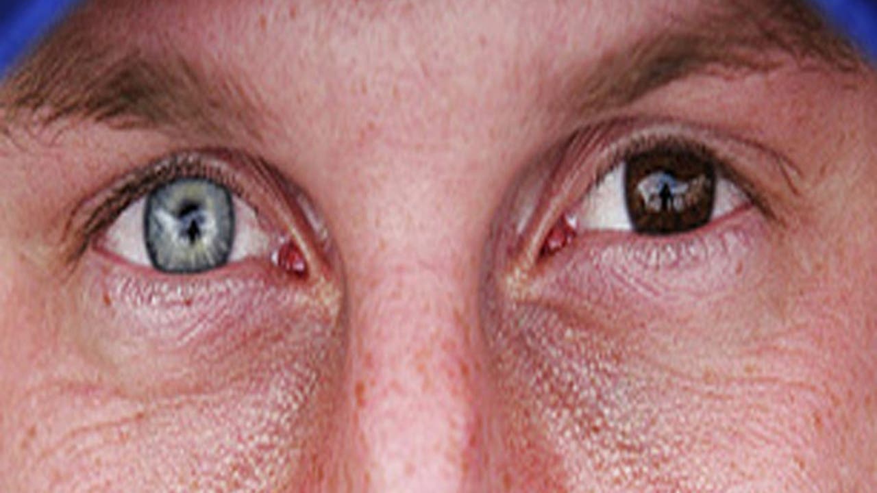 Celebrities With Two Different Color Eyes | Fox News, image size:1280x720