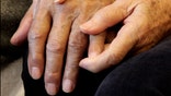 hand of husband with Alzheimers
