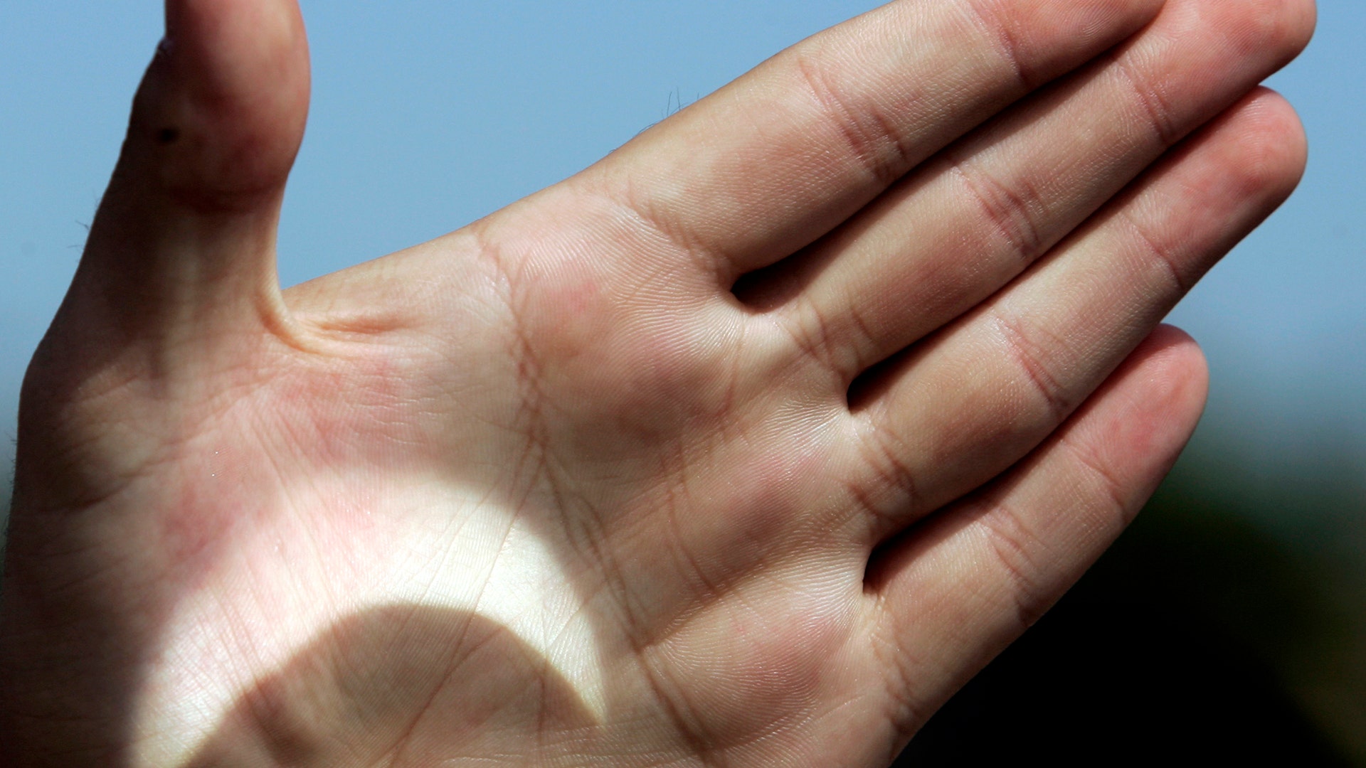 A man projects an image of the sun onto his hand during a partial solar eclipse seen outside Valletta, Malta, March 29, 2006